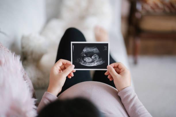 Фото Ни с чем не спутать: 10 первых признаков беременности на раннем сроке 9