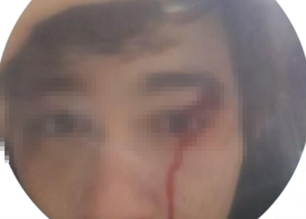 Фото В Бердске прохожий мужчина без причины ударил подростка 2