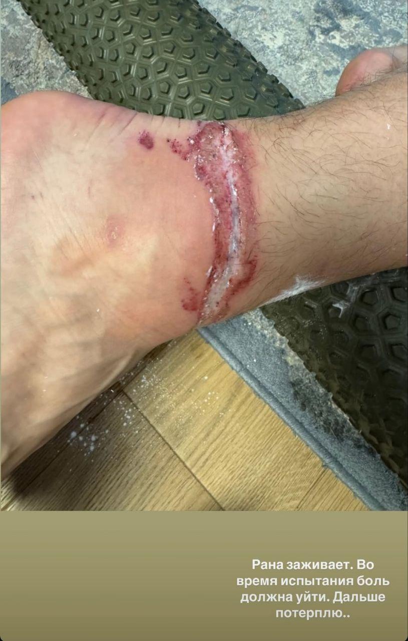 Фото Новосибирский борец Роман Власов получил травму ноги на шоу «Титаны» 2 - Сиб.ФМ Фото Новосибирский борец Роман Власов получил травму ноги на шоу «Титаны» 2