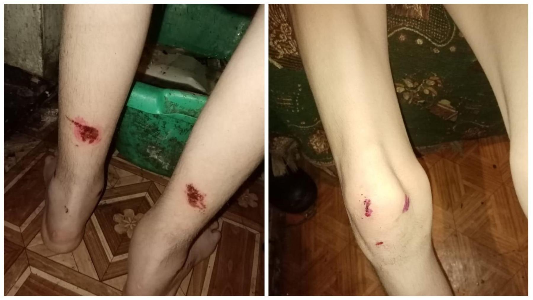 Фото Сообщения с угрозами начали поступать родственнице подростка из Ояшинского дома-интерната 2