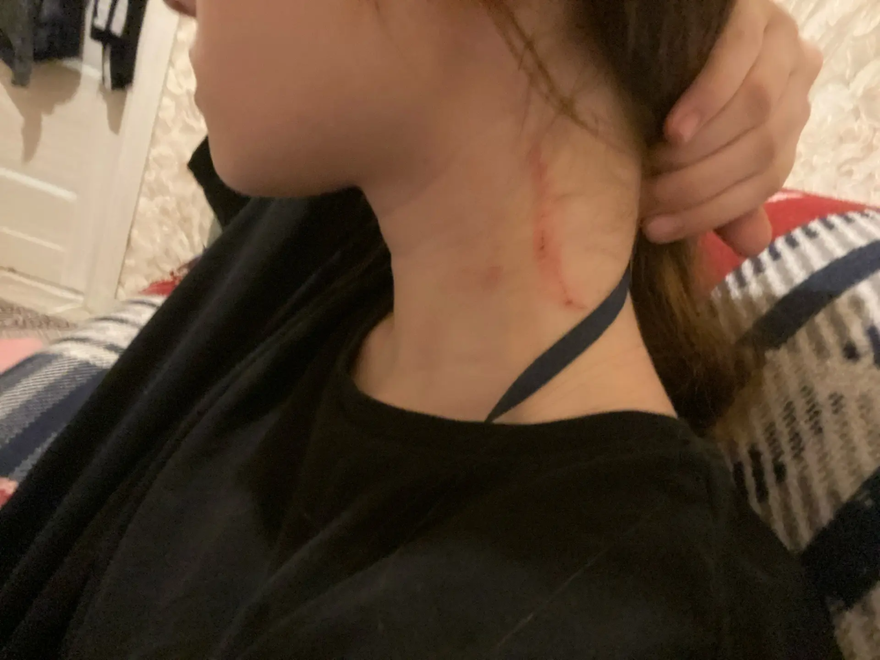 Фото Школьница лишилась половины волос из-за нападения хулиганок в новосибирском МФК «Сан Сити» 3