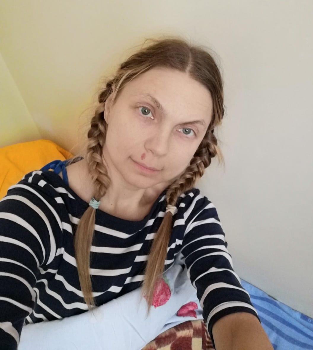 фото «Даже в инвалидное кресло сама сесть не могу»: мать-одиночка из Новосибирска попала в больницу с переломами и заразилась коронавирусом 2