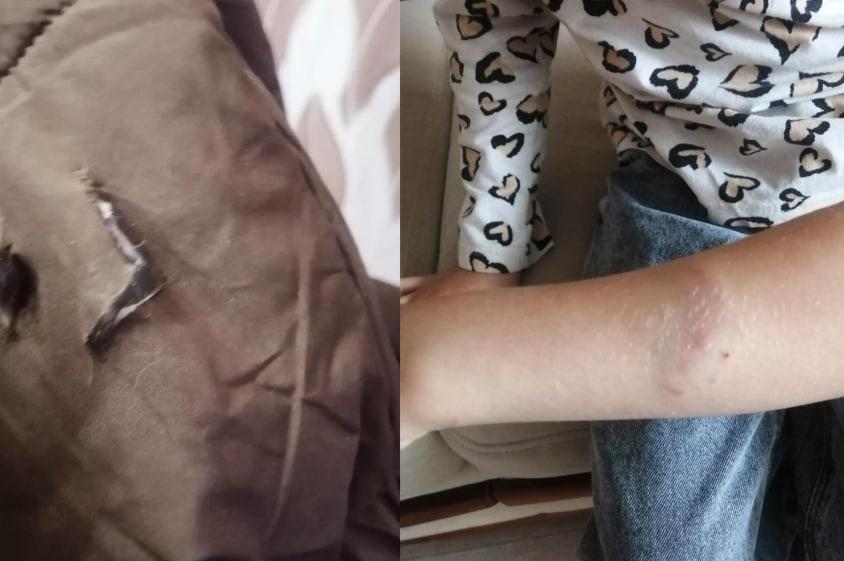 Фото Незаконные премии, нападение собаки на девочку и обращение голодающего депутата к Путину: главное в Новосибирске за 11 ноября 3