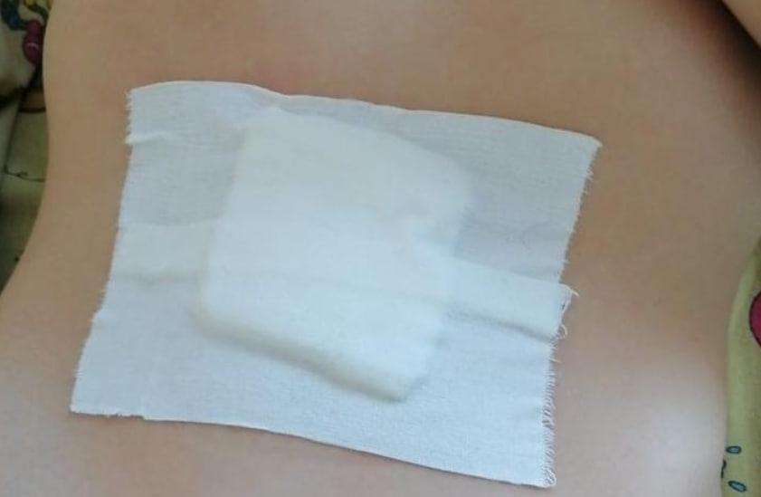 Фото Похищение мужчины, поджог дома и удаление мнимой грыжи: главное в Новосибирске за 20 ноября 2 - Сиб.ФМ Фото Похищение мужчины, поджог дома и удаление мнимой грыжи: главное в Новосибирске за 20 ноября 2