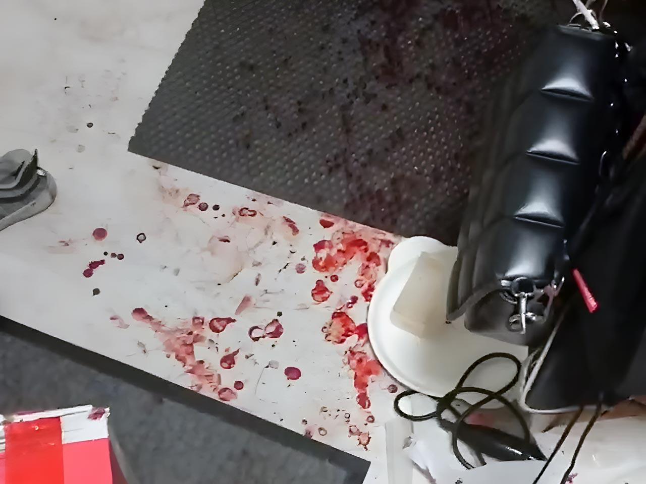 Фото В Мочище Новосибирской области мужчина ранил ножом бывшего мужа своей сожительницы 2 - Сиб.ФМ Фото В Мочище Новосибирской области мужчина ранил ножом бывшего мужа своей сожительницы 2